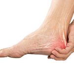 Busting the Painful Myth: A Deep Dive into Calcaneal Bursitis